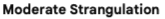 moderate strangulation